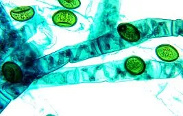 Как выбрать увеличение микроскопа в зависимости от задач?