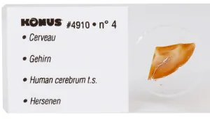 Набор микропрепаратов Konus 10: «Человеческое тело. Норма», изображение 3